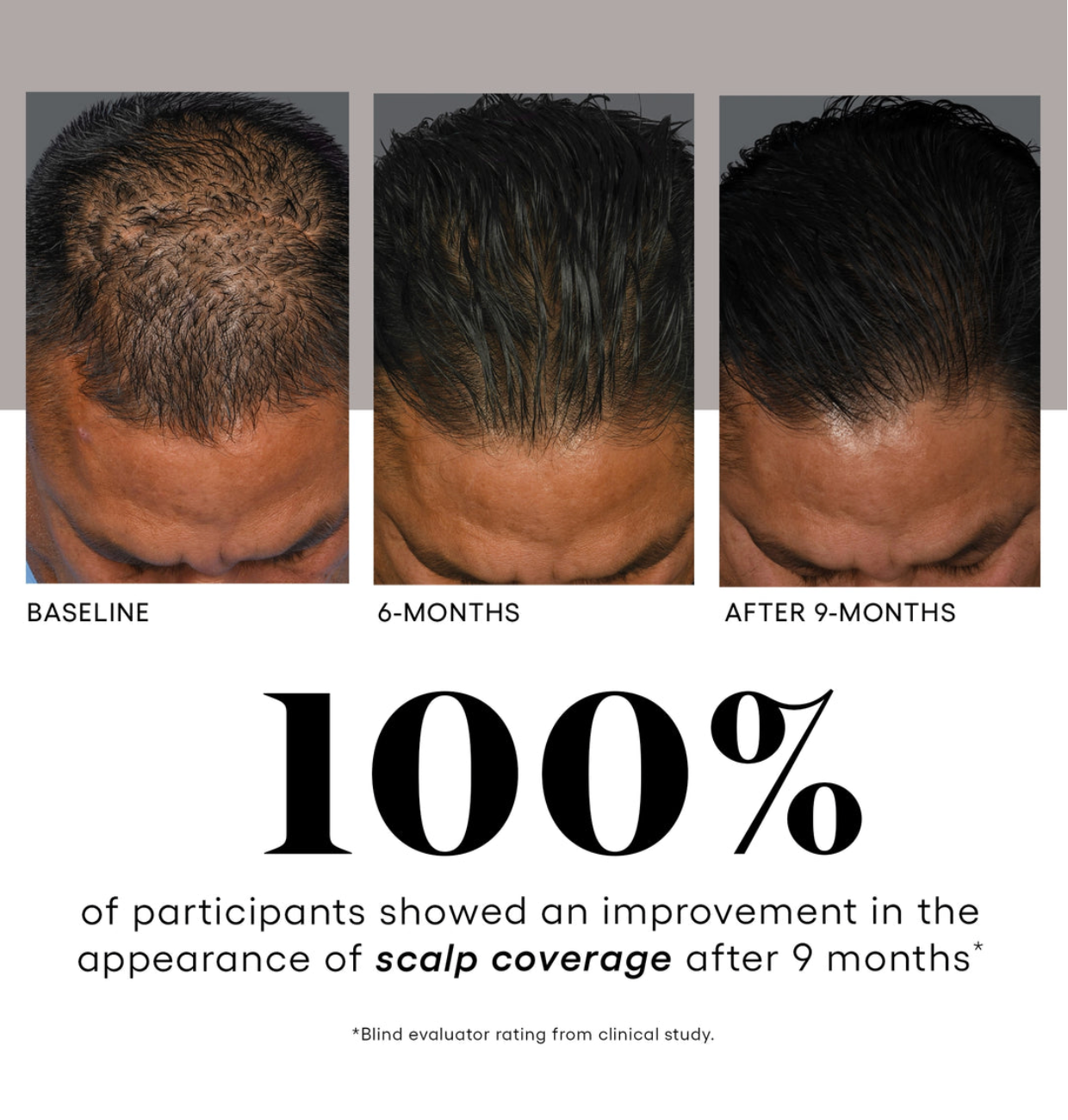 Scalp Stimulator Stack