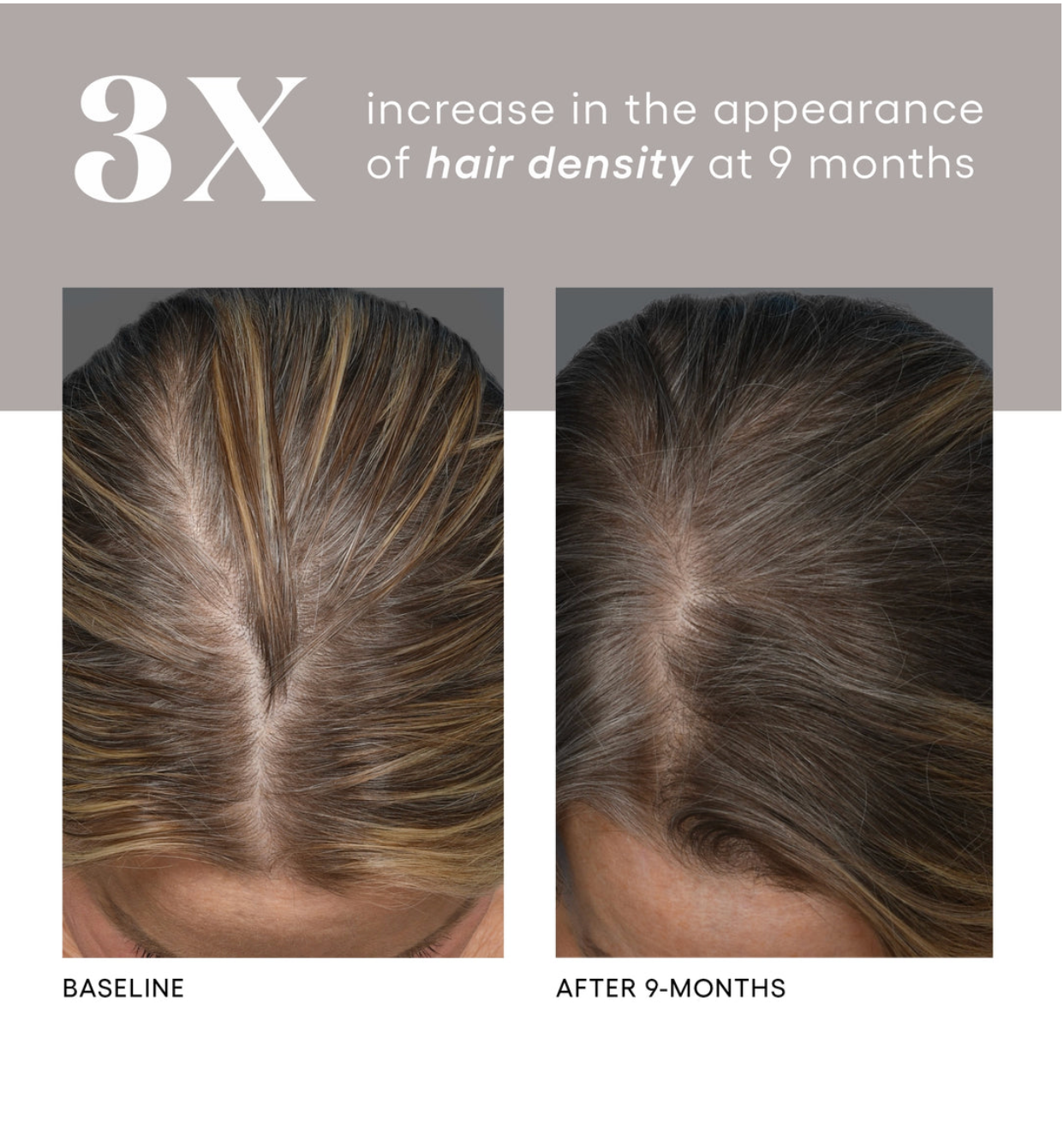 Scalp Stimulator Stack