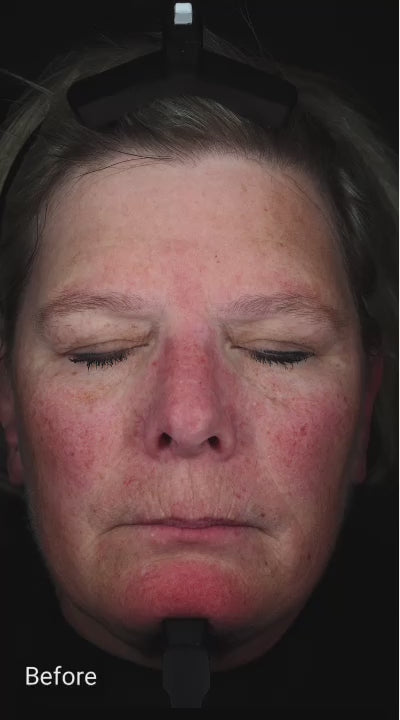 Intensive Repair Serum