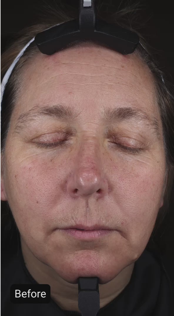 Intensive Repair Serum