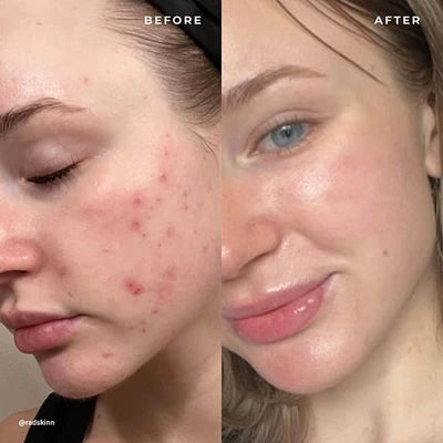 8% Mandelic Acid Serum