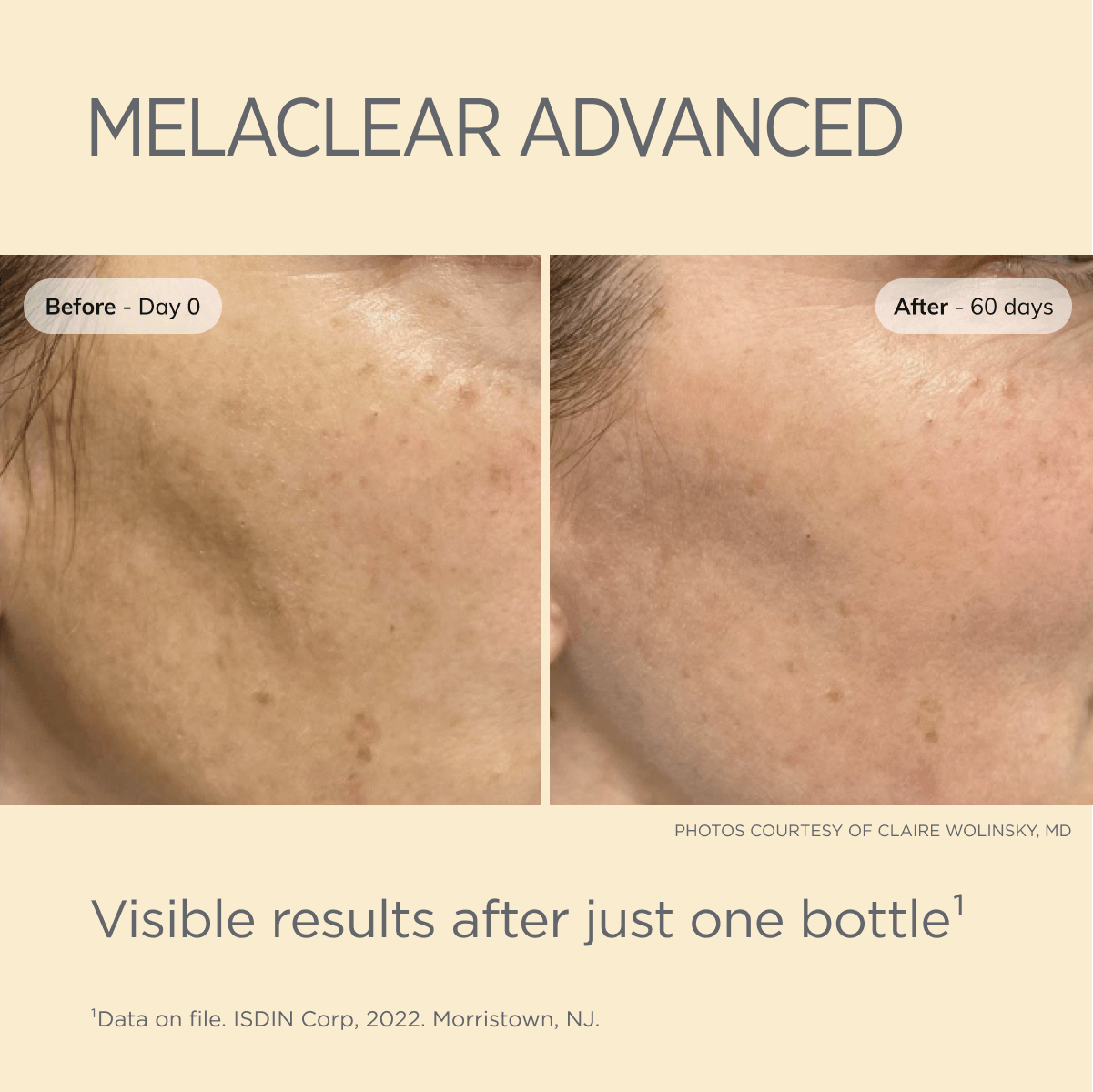 Melaclear Advanced Serum