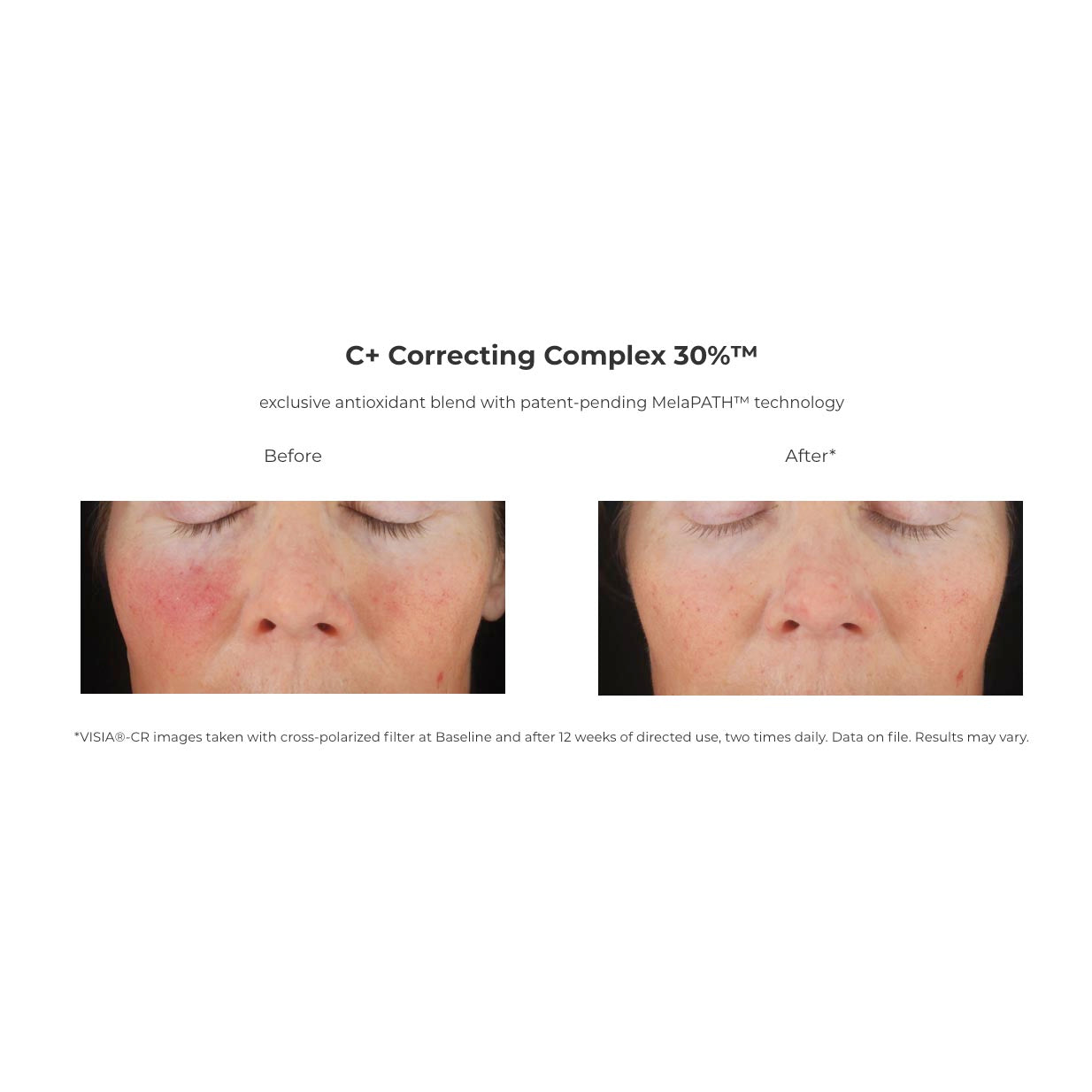 C+ Correcting Complex 30% Serum