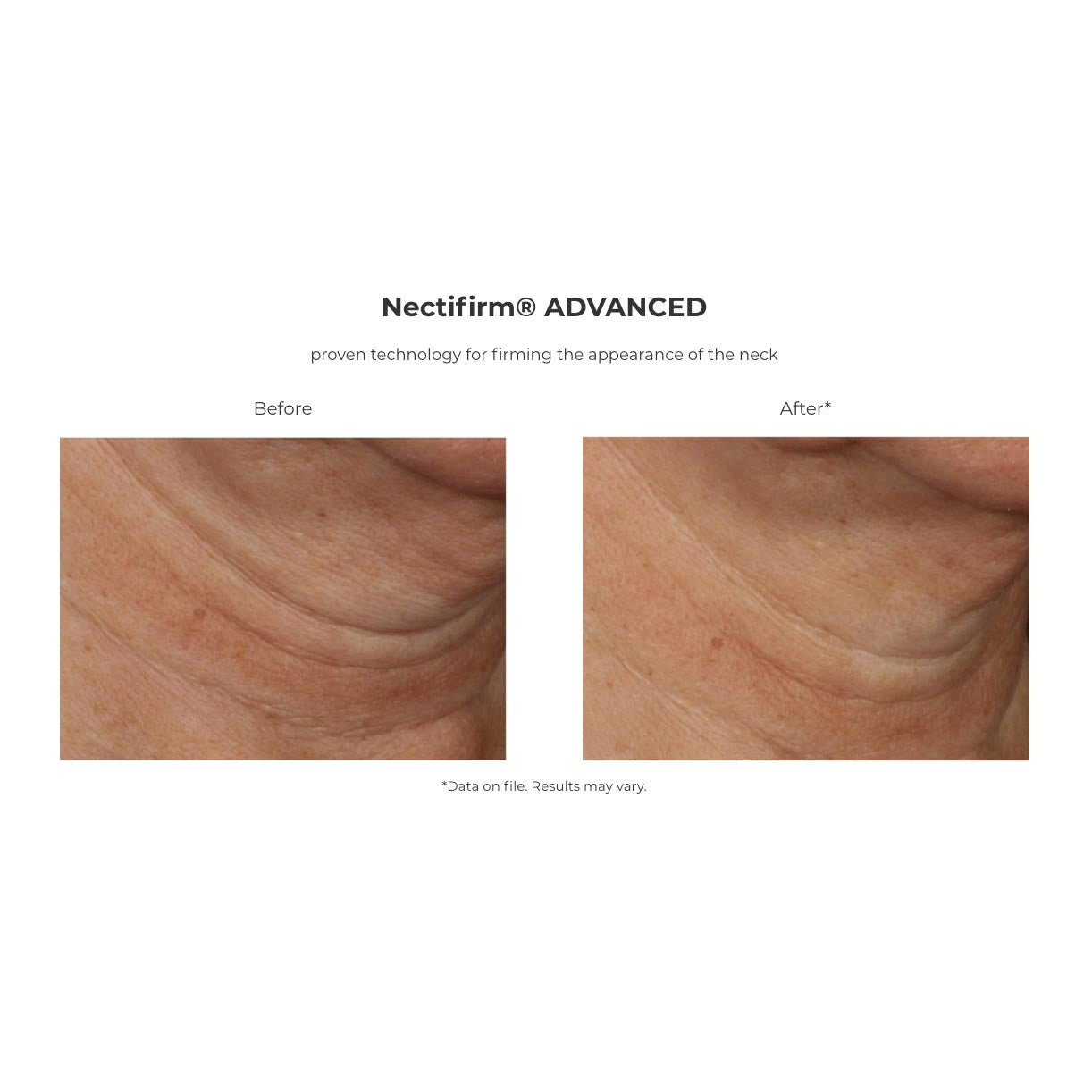 Nectifirm Advanced